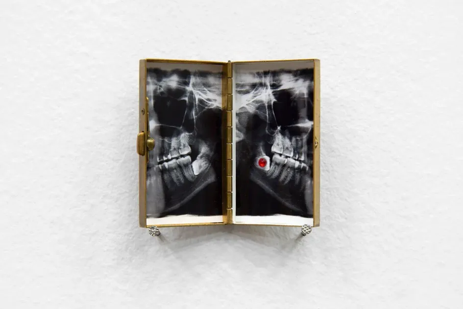 Ruoxi Jin, Ruoxi Jin, Germe (Ruoxi), 2025, RJ9 | Artworks | Mennour